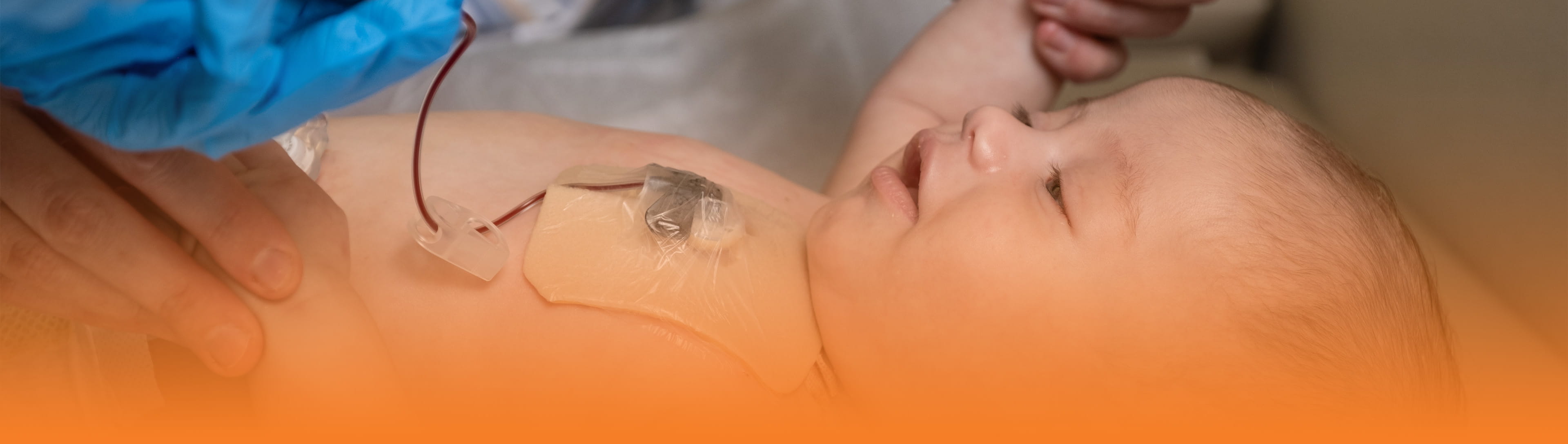 Infant boy laying on clinic bed.